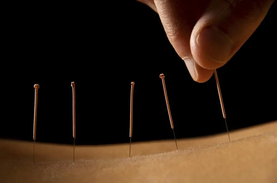 Jayam Acupuncture & Pain Relief Centre